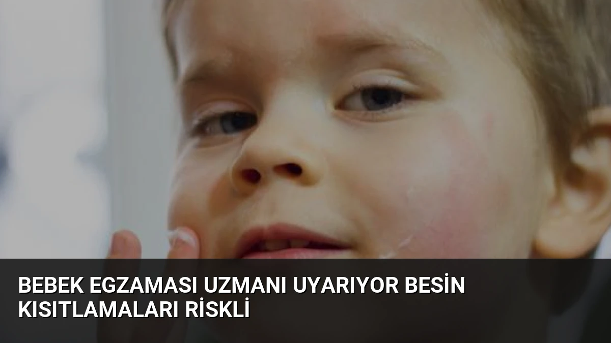 Bebek Egzaması Uzmanı Uyarıyor Besin Kısıtlamaları Riskli