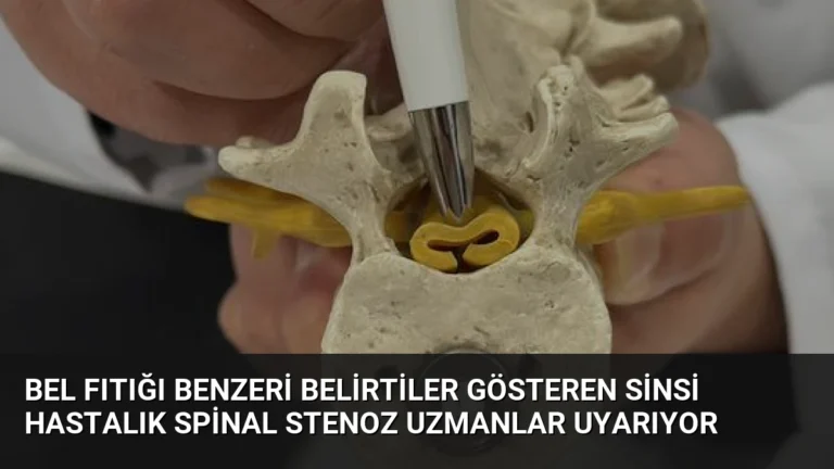 Bel Fıtığı Benzeri Belirtiler Gösteren Sinsi Hastalık Spinal Stenoz Uzmanlar Uyarıyor