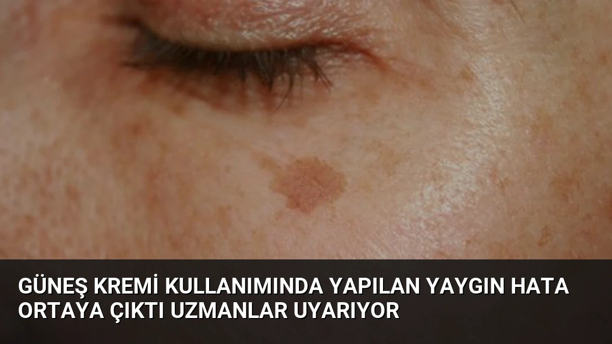Güneş Kremi Kullanımında Yapılan Yaygın Hata Ortaya Çıktı Uzmanlar Uyarıyor